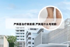 严枫喜治疗银屑病 严枫是什么电视剧