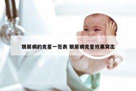 银屑病的克星一览表 银屑病克星效果突出