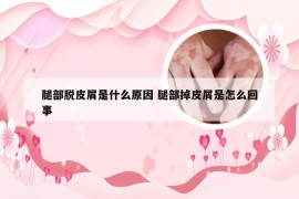 腿部脱皮屑是什么原因 腿部掉皮屑是怎么回事