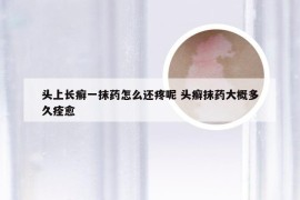 头上长癣一抹药怎么还疼呢 头癣抹药大概多久痊愈