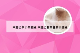 大腿上长小白圆点 大腿上有白色的小圆点