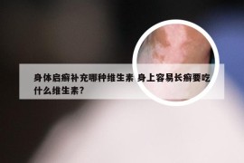 身体启癣补充哪种维生素 身上容易长癣要吃什么维生素?