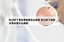 伤口好了发白类似癣怎么回事 伤口好了后有点发白是什么原因