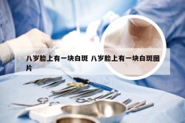 八岁脸上有一块白斑 八岁脸上有一块白斑图片