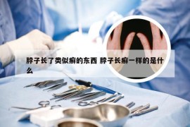 脖子长了类似癣的东西 脖子长癣一样的是什么