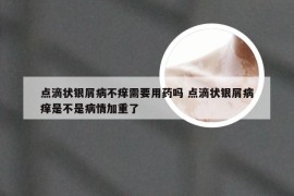 点滴状银屑病不痒需要用药吗 点滴状银屑病痒是不是病情加重了