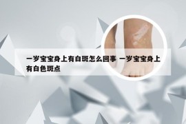 一岁宝宝身上有白斑怎么回事 一岁宝宝身上有白色斑点