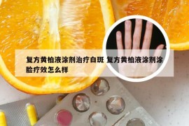 复方黄柏液涂剂治疗白斑 复方黄柏液涂剂涂脸疗效怎么样