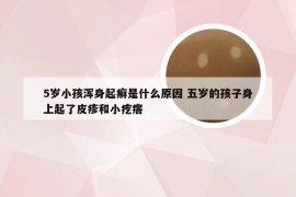 5岁小孩浑身起癣是什么原因 五岁的孩子身上起了皮疹和小疙瘩