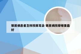 银屑病患者怎样按摩耳朵 银屑病按摩哪里最好