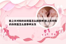 脸上长对称的白斑是怎么回事啊 脸上长对称的白斑是怎么回事啊女生