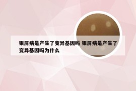 银屑病是产生了变异基因吗 银屑病是产生了变异基因吗为什么