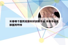 长春哪个医院皮肤科好创新华山 长春华山皮肤医院咋样