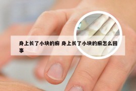 身上长了小块的癣 身上长了小块的癣怎么回事