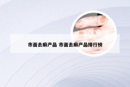 市面去癣产品 市面去癣产品排行榜