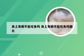 身上有癣不能吃鱼吗 身上有癣不能吃鱼吗图片