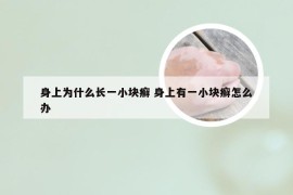 身上为什么长一小块癣 身上有一小块癣怎么办