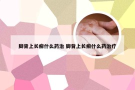 脚背上长癣什么药治 脚背上长癣什么药治疗