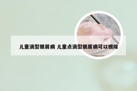 儿童滴型银屑病 儿童点滴型银屑病可以根除