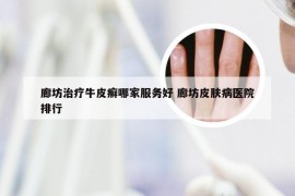 廊坊治疗牛皮癣哪家服务好 廊坊皮肤病医院排行