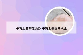 手臂上有癣怎么办 手臂上癣图片大全