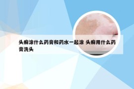 头癣涂什么药膏和药水一起涂 头癣用什么药膏洗头