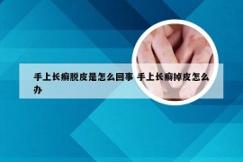 手上长癣脱皮是怎么回事 手上长癣掉皮怎么办