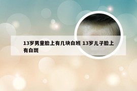 13岁男童脸上有几块白班 13岁儿子脸上有白斑