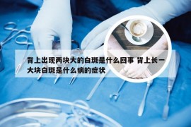 背上出现两块大的白斑是什么回事 背上长一大块白斑是什么病的症状