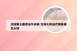 沈阳第七医院治牛皮癣 沈阳七院治疗银屑病怎么样