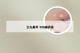 三九癣平 999癣药膏