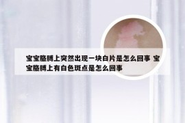 宝宝胳膊上突然出现一块白片是怎么回事 宝宝胳膊上有白色斑点是怎么回事