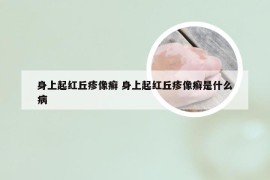 身上起红丘疹像癣 身上起红丘疹像癣是什么病