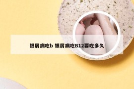 银屑病吃b 银屑病吃B12要吃多久