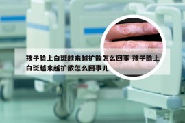 孩子脸上白斑越来越扩散怎么回事 孩子脸上白斑越来越扩散怎么回事儿