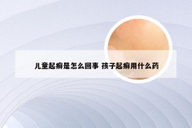 儿童起癣是怎么回事 孩子起癣用什么药