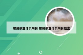 银屑病查什么项目 银屑病查什么项目检查