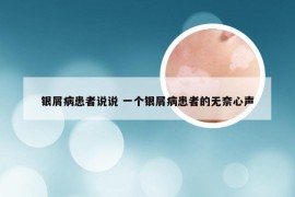 银屑病患者说说 一个银屑病患者的无奈心声