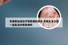 克银散加减治疗银屑病的体会 克银丸多少钱一盒能治好银屑病吗