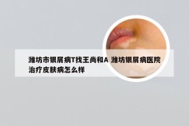 潍坊市银屑病T找王尚和A 潍坊银屑病医院治疗皮肤病怎么样