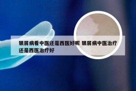 银屑病看中医还是西医好呢 银屑病中医治疗还是西医治疗好