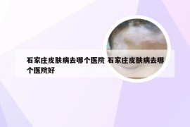 石家庄皮肤病去哪个医院 石家庄皮肤病去哪个医院好