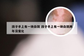 孩子手上有一块白斑 孩子手上有一块白斑两年没变化