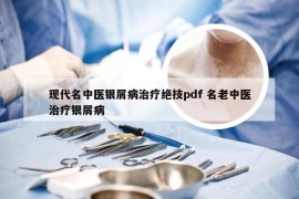 现代名中医银屑病治疗绝技pdf 名老中医治疗银屑病