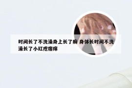 时间长了不洗澡身上长了癣 身体长时间不洗澡长了小红疙瘩痒