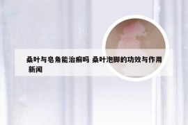 桑叶与皂角能治癣吗 桑叶泡脚的功效与作用 新闻