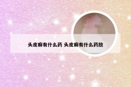 头皮癣有什么药 头皮癣有什么药放