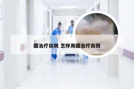 醋治疗白斑 怎样用醋治疗白斑