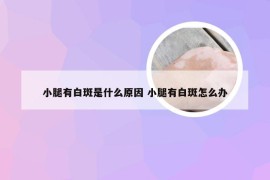 小腿有白斑是什么原因 小腿有白斑怎么办