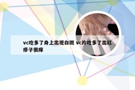 vc吃多了身上出现白斑 vc片吃多了出红疹子很痒